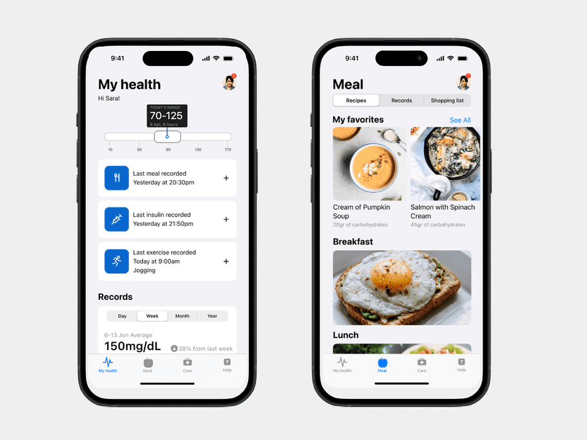 Gluca - iOS native design preview